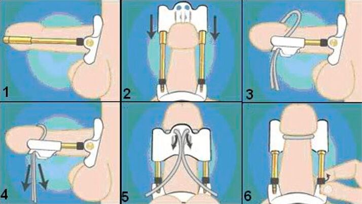 تکنیک نهایی